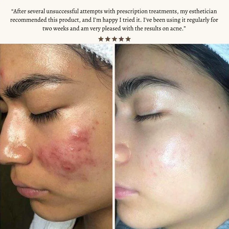 Varita de Belleza Hexibella