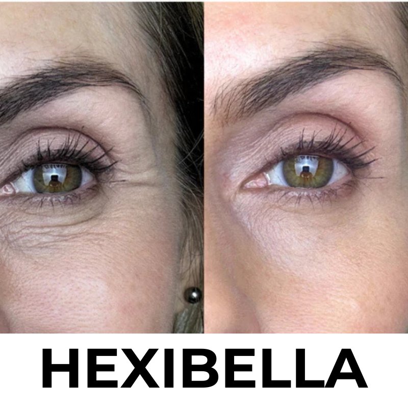 Dispositivo Hexibella MicroGlow