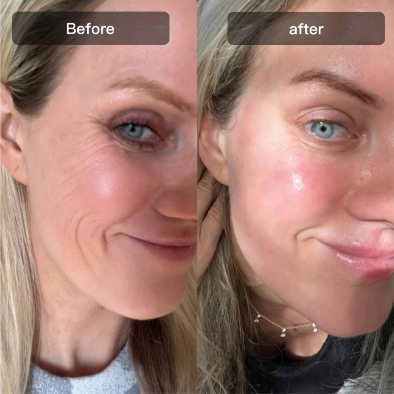 Dispositivo Hexibella MicroGlow