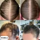Hexibella Serum Capilar 5 en 1