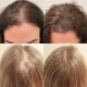 Hexibella Serum Capilar 5 en 1