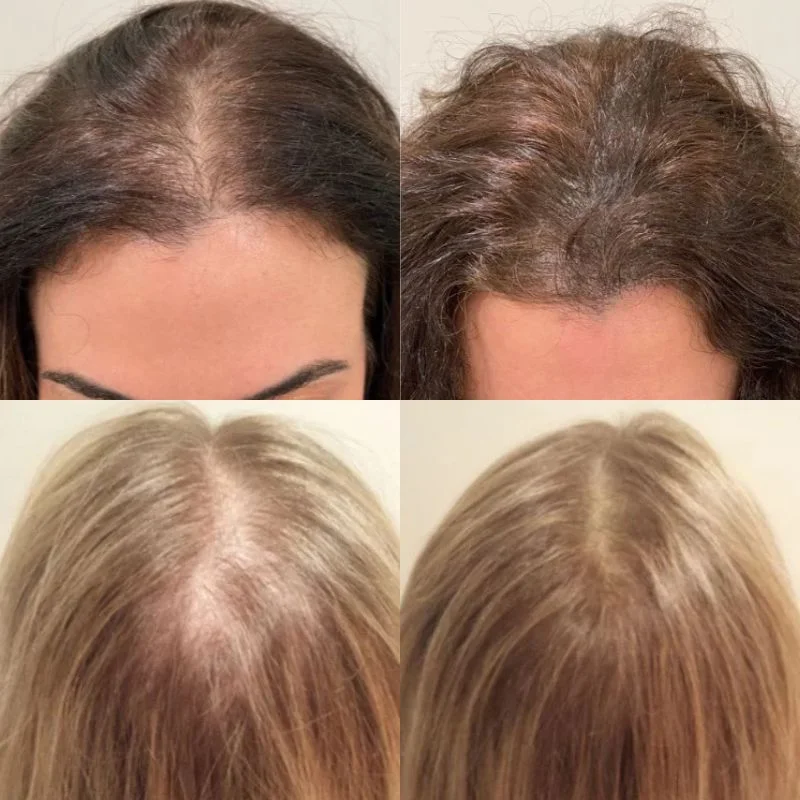 Hexibella Serum Capilar 5 en 1