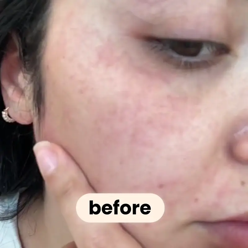 Mascarilla Coreana Bio-Colágeno