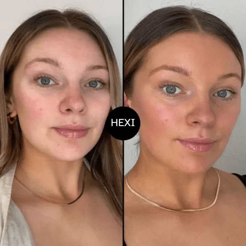 Hexi-beforeandafter (1) Hexi Tanning Drops
