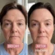 hexibella-005 Collagen Bundle